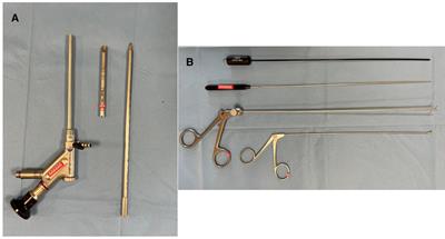 Full-endoscopic removal of third ventricular colloid cysts: technique, results, and limitations